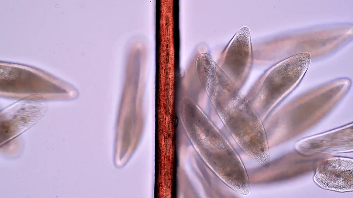 Инфузории на фоне человеческого волоса