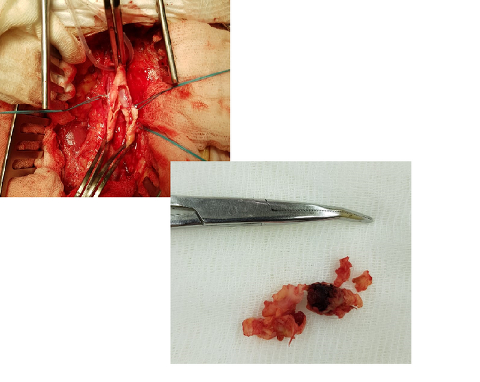 Вверху - это сосуды, внизу - хлам, который из них удалось достать.