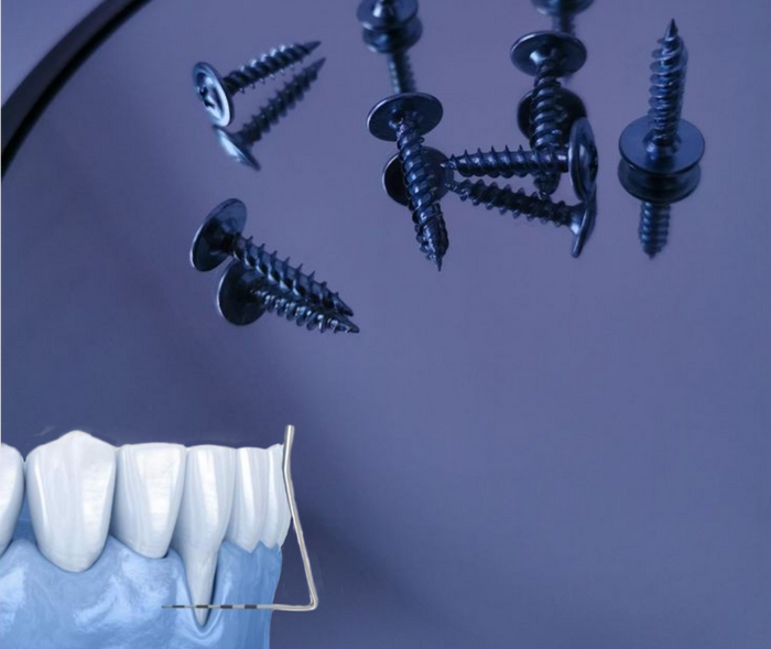 Рецессия десны как результат травмы