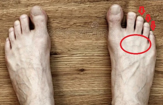 Непонятная боль в голеностопе