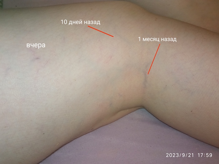 (������������ ��������� ���)