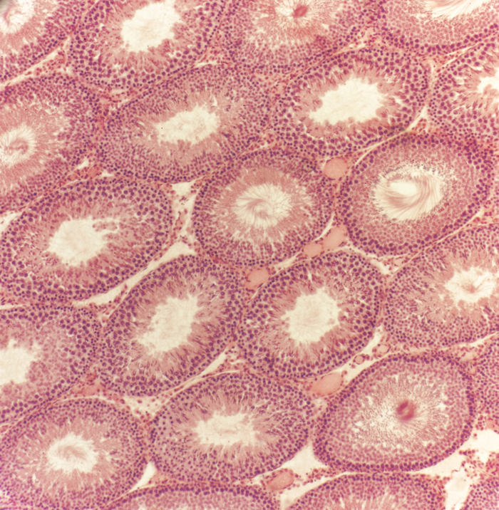 Семенник, увеличение 10 х 4