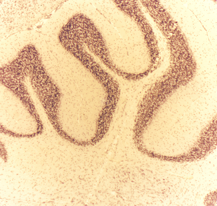 Мозжечок, увеличение 10 х 2.5