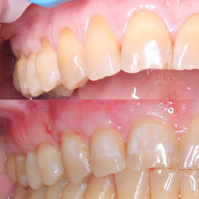 �� � ����� ������ ���� (2 ������).