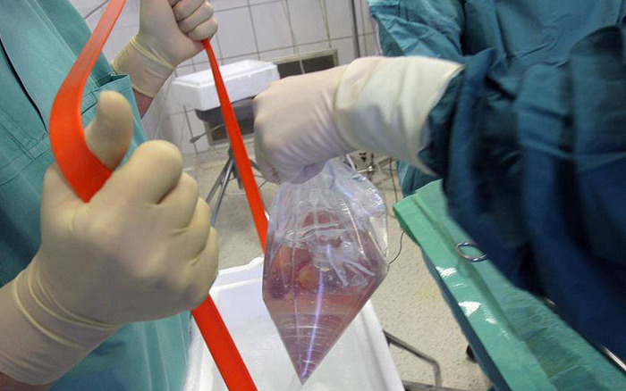 �������������� ����� ���� ������� ������ (����� � �����)