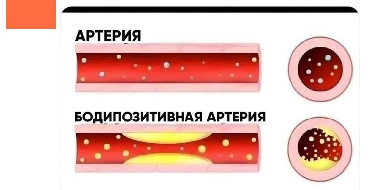 Бодипозитив | Пикабу