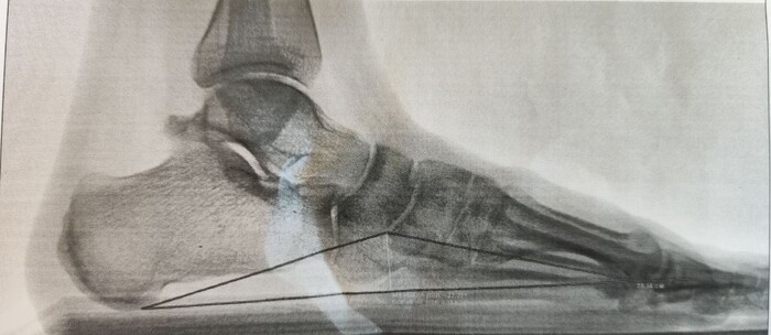 ����� �����