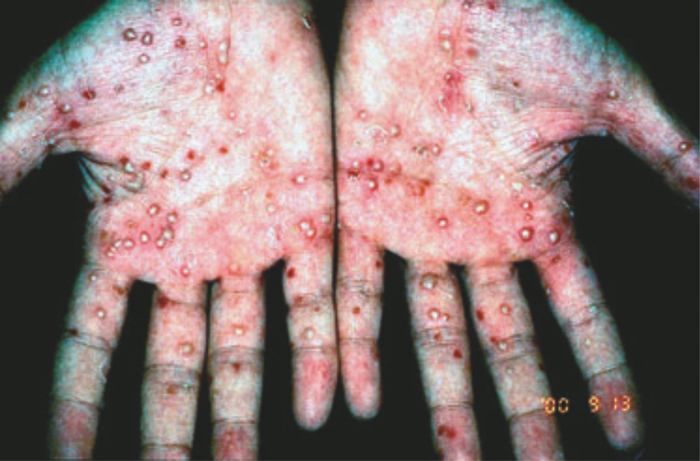 ������� 6 | ���, ����� ��������� ��� ������������ �������