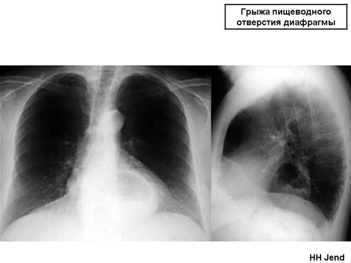 19 -  ,      ( ,     . .).