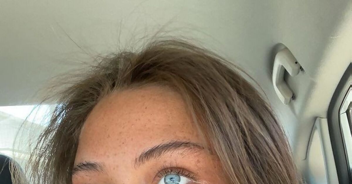 Sidney passionfruit leak