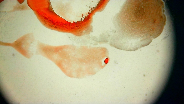 Кровь человека. Увеличение: x100 раз