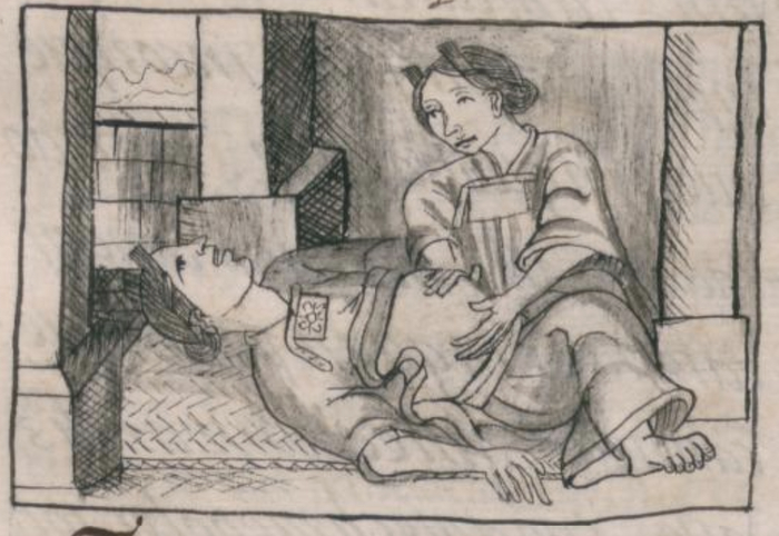 Акушерка делает массаж своей пациентке / Флорентийский кодекс