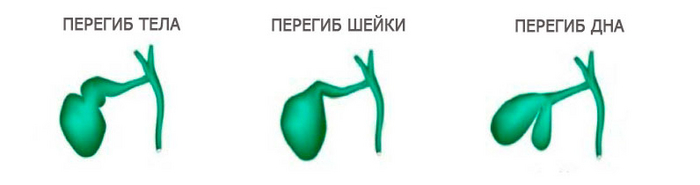 ���� �������� ��������