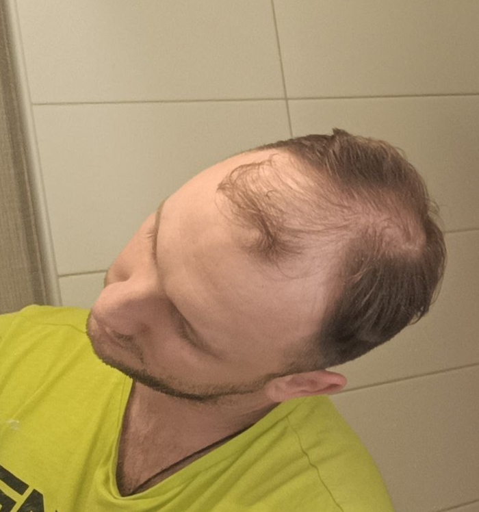 (-)      , , , , 