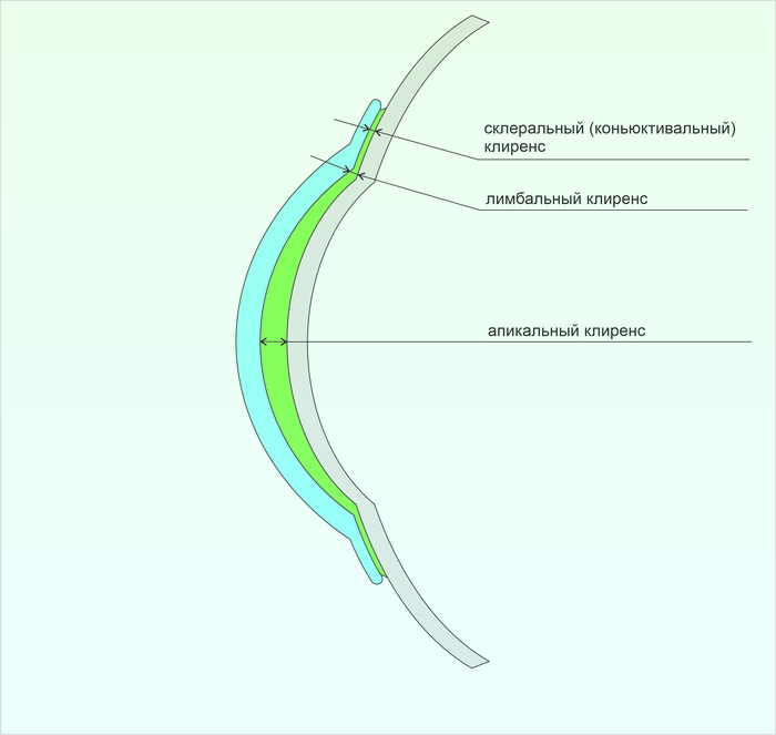 Так склеральная линза сидит на глазу