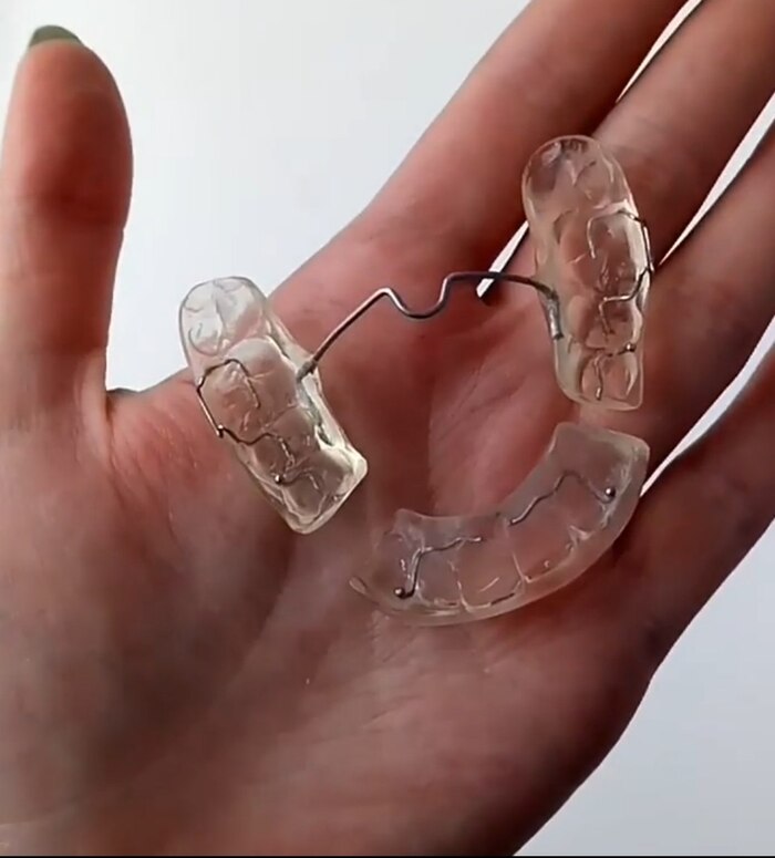 Составной сплинт на верхнюю челюсть.