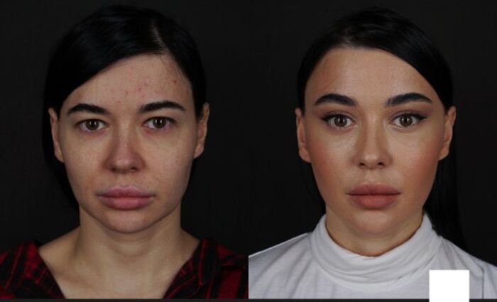 "Естественная" красота на пикабу за 40