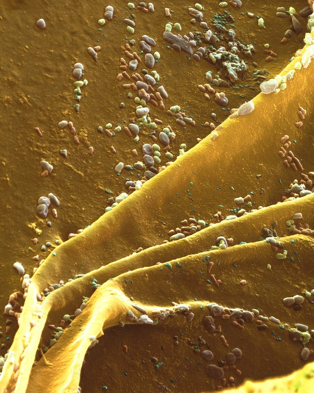 Бактерии на поверхности губки. Увеличение: x3000 раз. Сканирующий электронный микроскоп