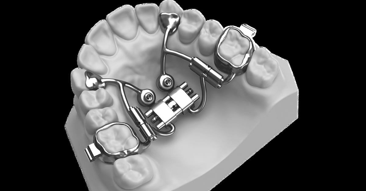Продолжение 3 (FitFree) | Пикабу