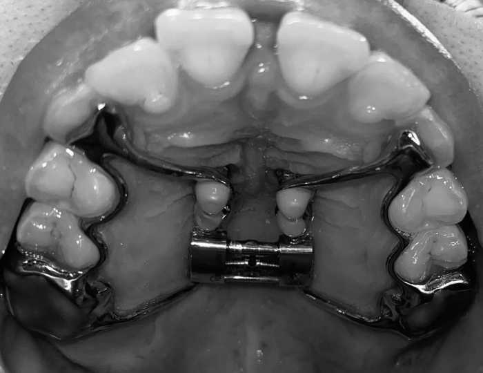 �������. 9 ���� ����� ��������� 