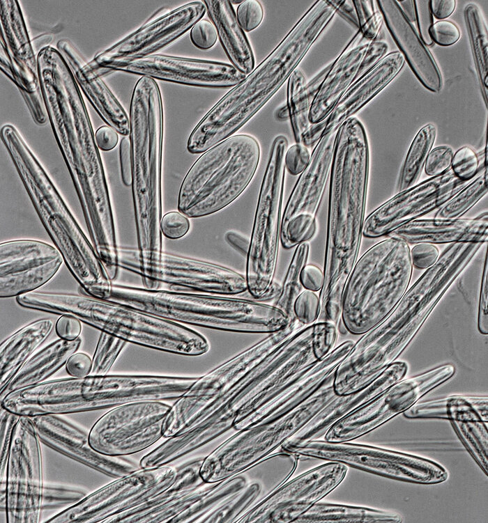 Нематоциды "морской осы". Внутри - один из самых смертельных в мире ядов