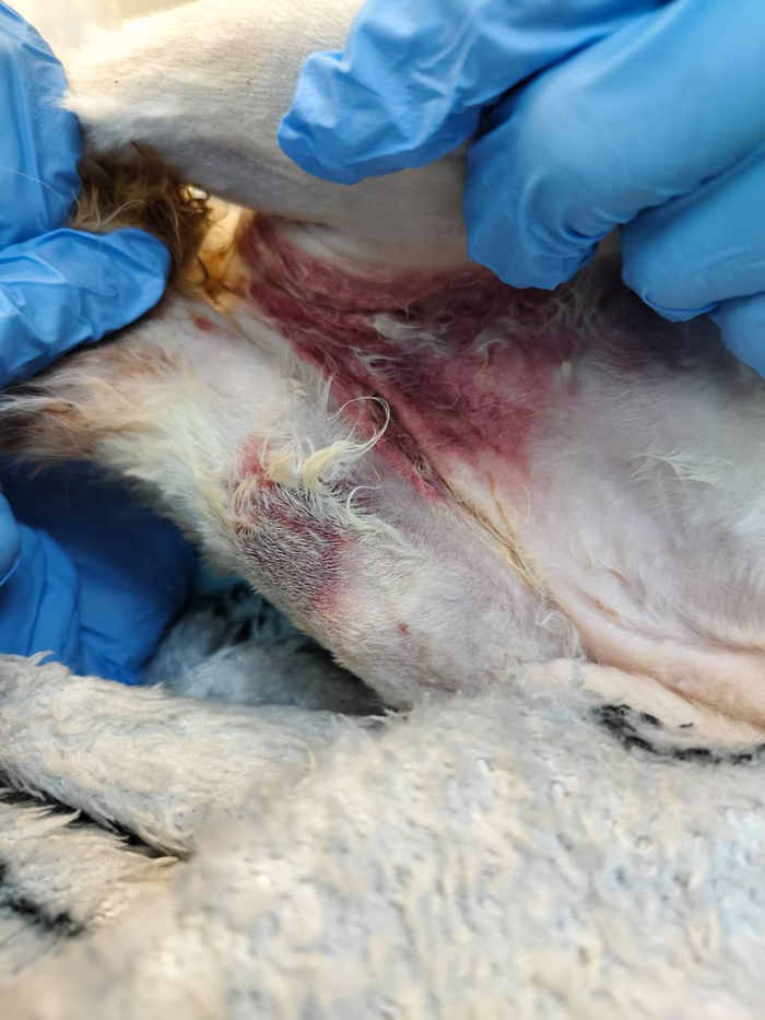 гематомы на теле