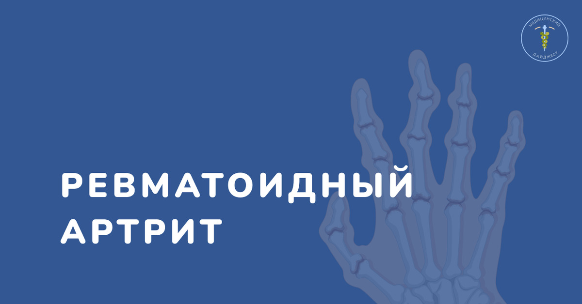 Ревматоидный артрит | Пикабу