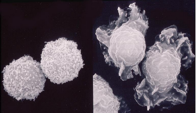 Активация нейтрофилов и кислородный взрыв.