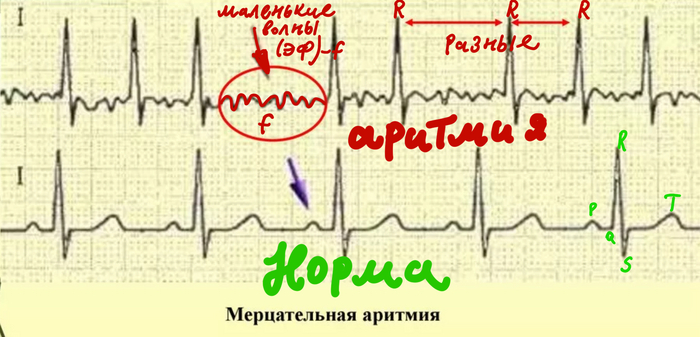    :   f       R.         PQRST