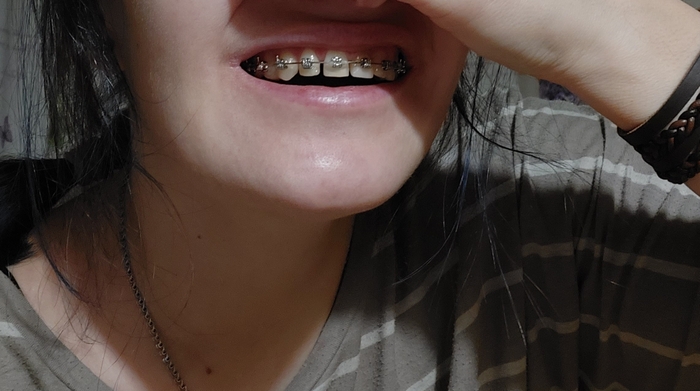 �������� � �������� �������.