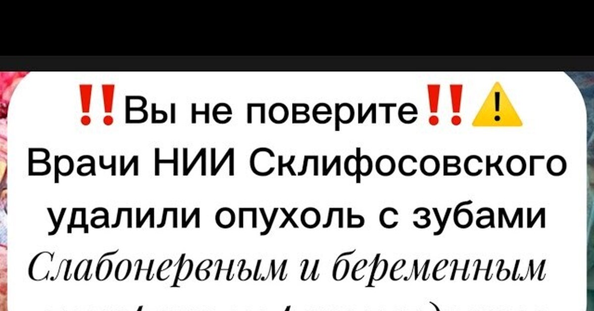 Тератома - опухоль монстр | Пикабу