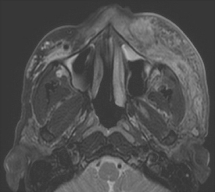 Figure 2 -,       ,    ,   2 ,     .