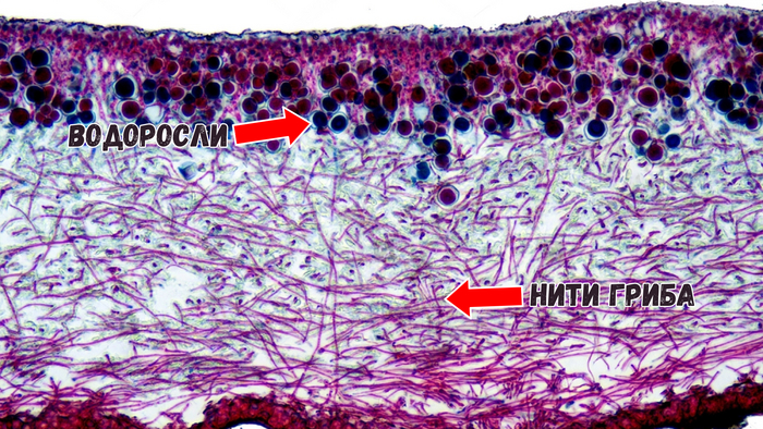 Лишайник под микроскопом. Препарат окрашен фиолетовым красителем. Хорошо видны клетки водорослей (тёмные шарики) и тонкие нити (гифы) гриба. Световой микроскоп.