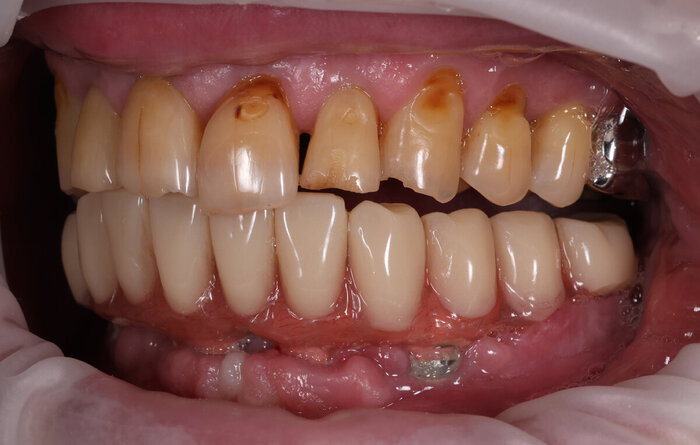 ��� - ����� �� ������, 6 ������