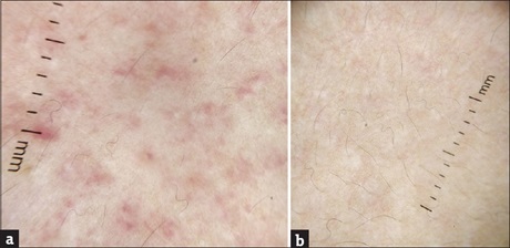 ()              . (b)            