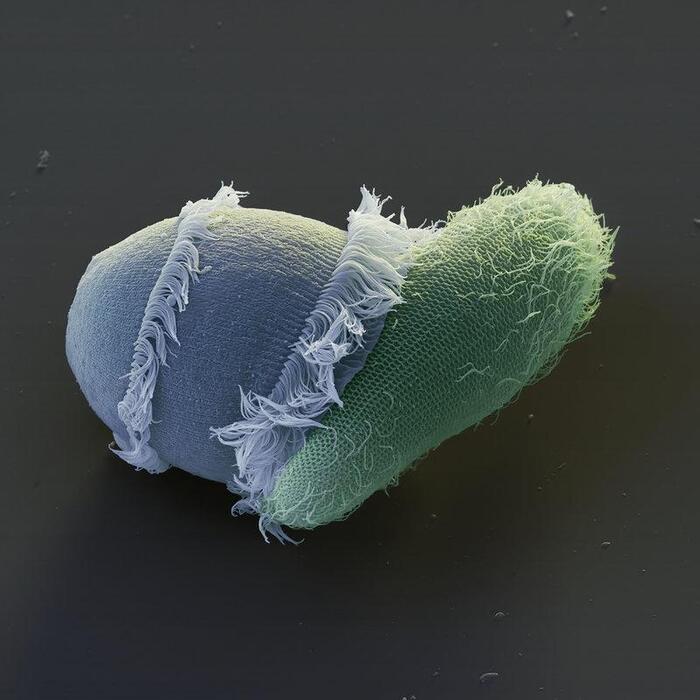 Хищная инфузория Дидиниум (Didinium sp.) поедает инфузорию-туфельку (Paramecium Caudatum). Сканирующий электронный микроскоп. Увеличение: x750 раз.