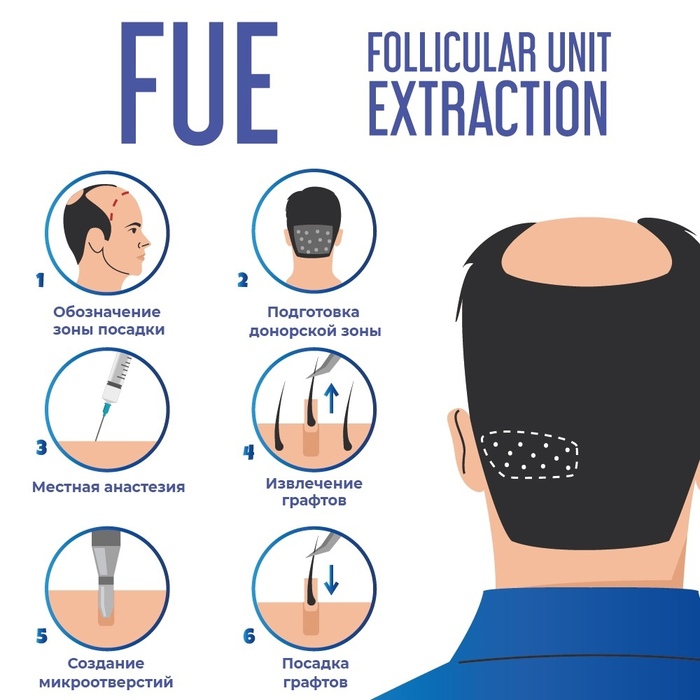 ���, ����������, � ��� �����