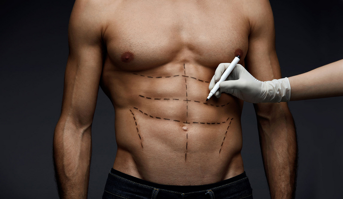 Локальное жиросжигание