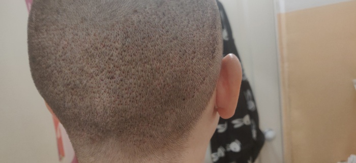 Вот как выглядит донорка