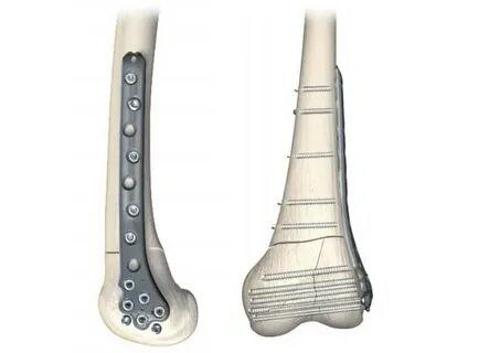 Вот еще пластина