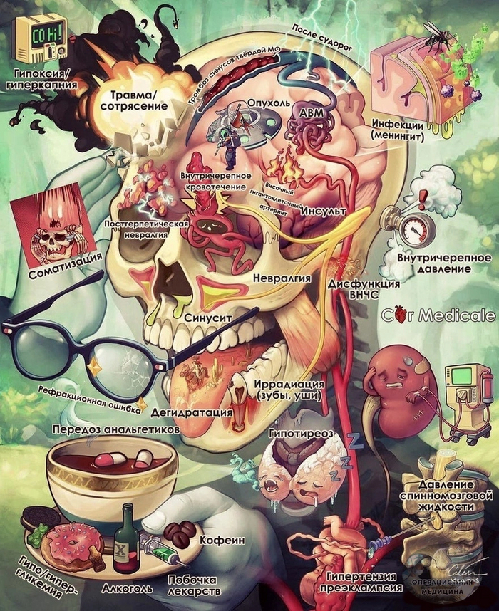 Причины головной боли