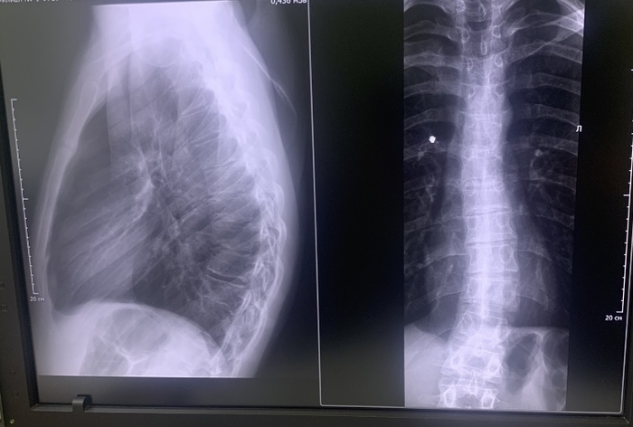  19                     , , , 