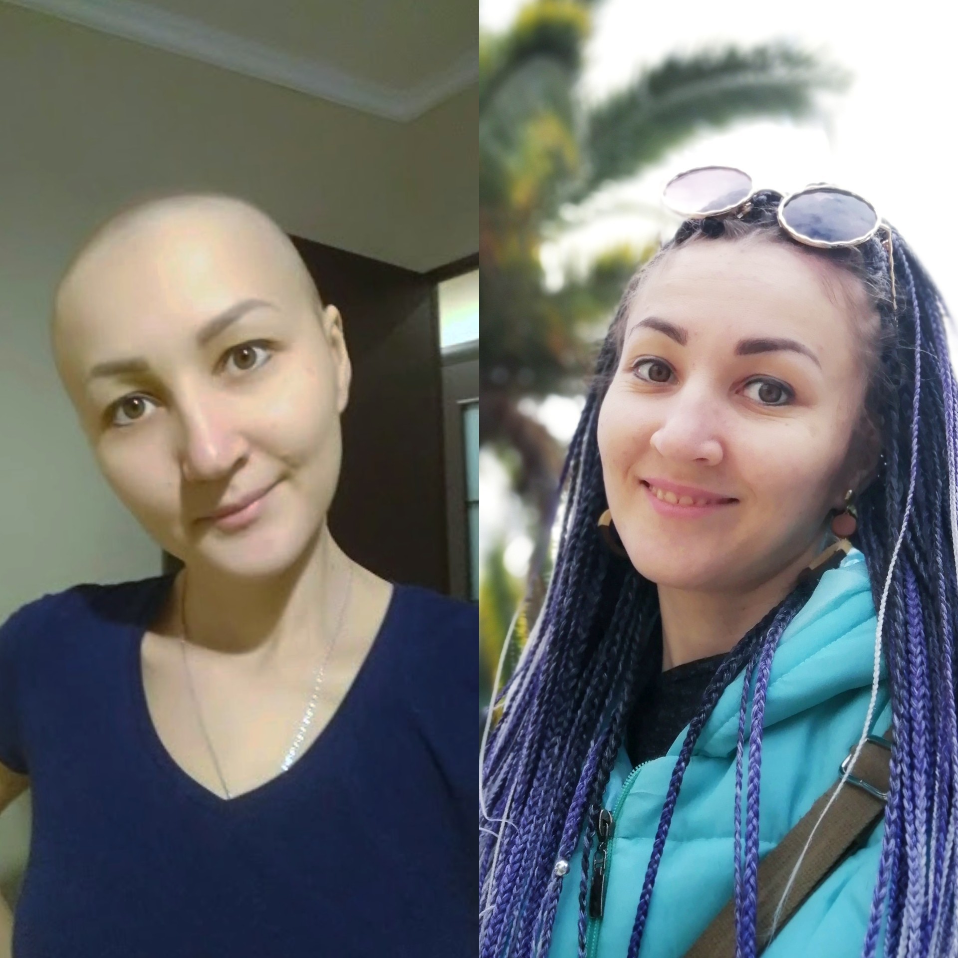 Раком После Фото