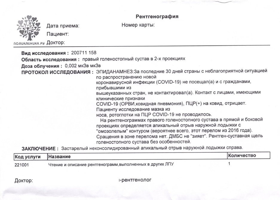 Застарелый апикальный отрыв наружной лодыжки | Пикабу