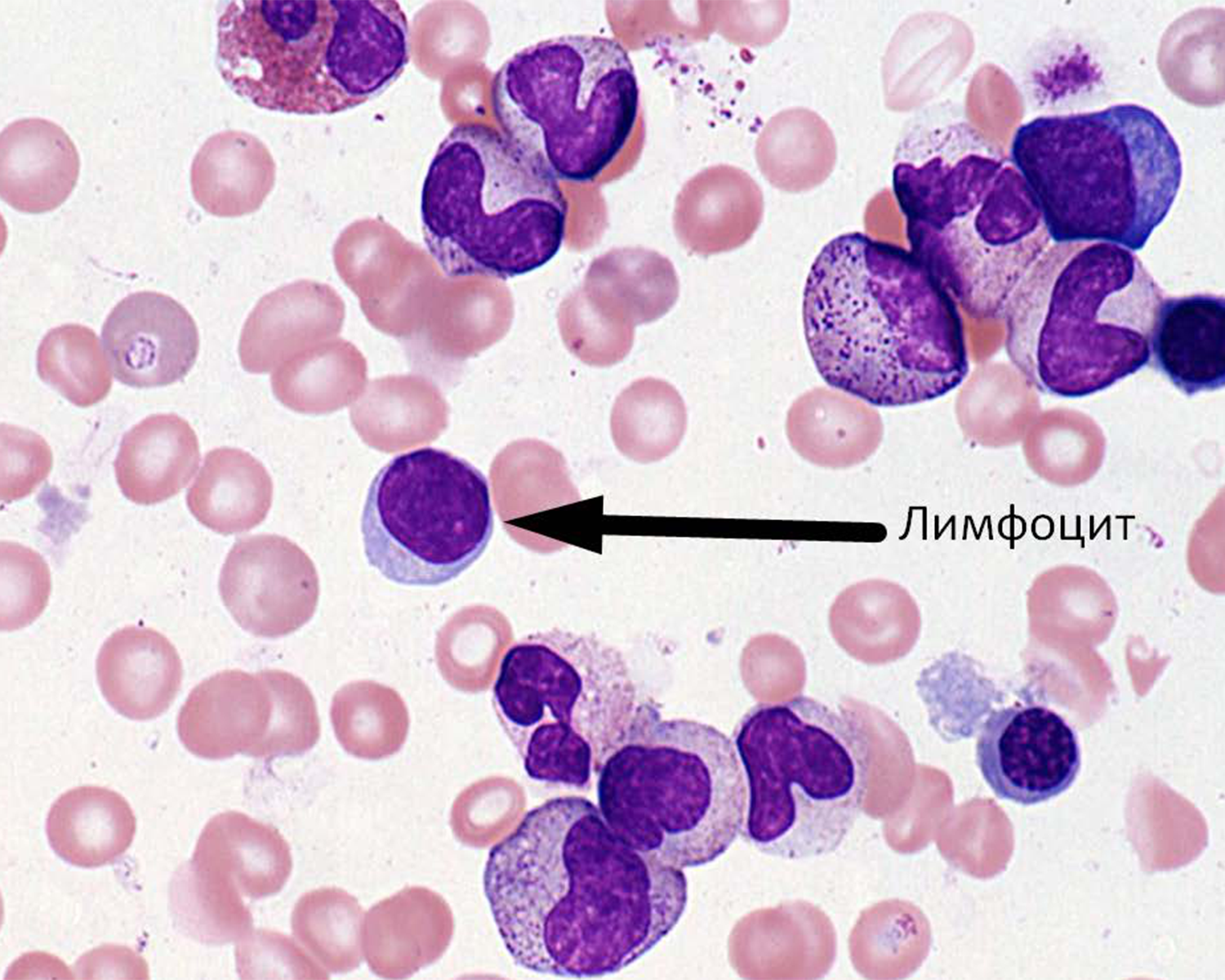 Т-лимфоцит мазок крови. Т лимфоциты в микроскопе. Лимфоциты в крови гистология. Моноцит гистология. Т клетки крови
