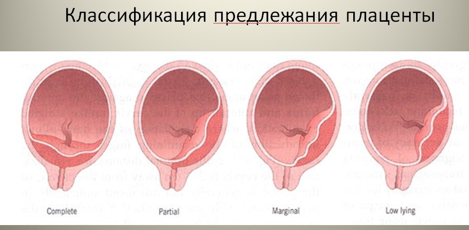 Консультация по применению пессариев Dr. Arabin - страница 24