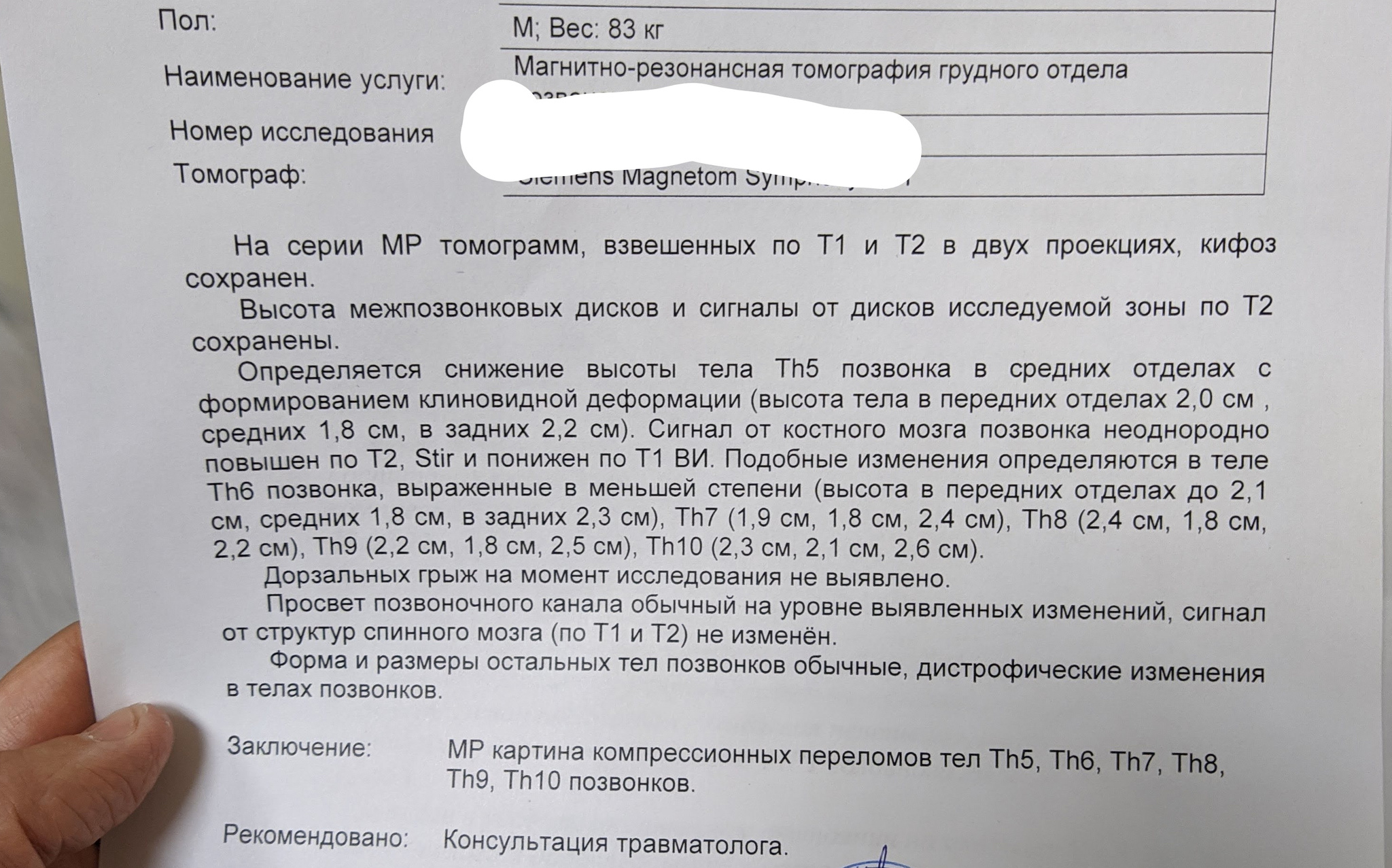 Продолжение саги про перелом позвоночника. Есть ли грамотный травматолог на  Пикабу? | Пикабу