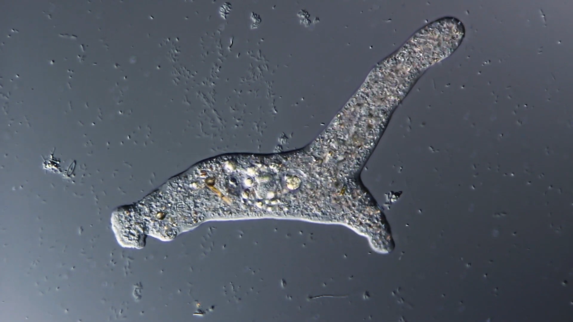 Амеба обыкновенная под микроскопом