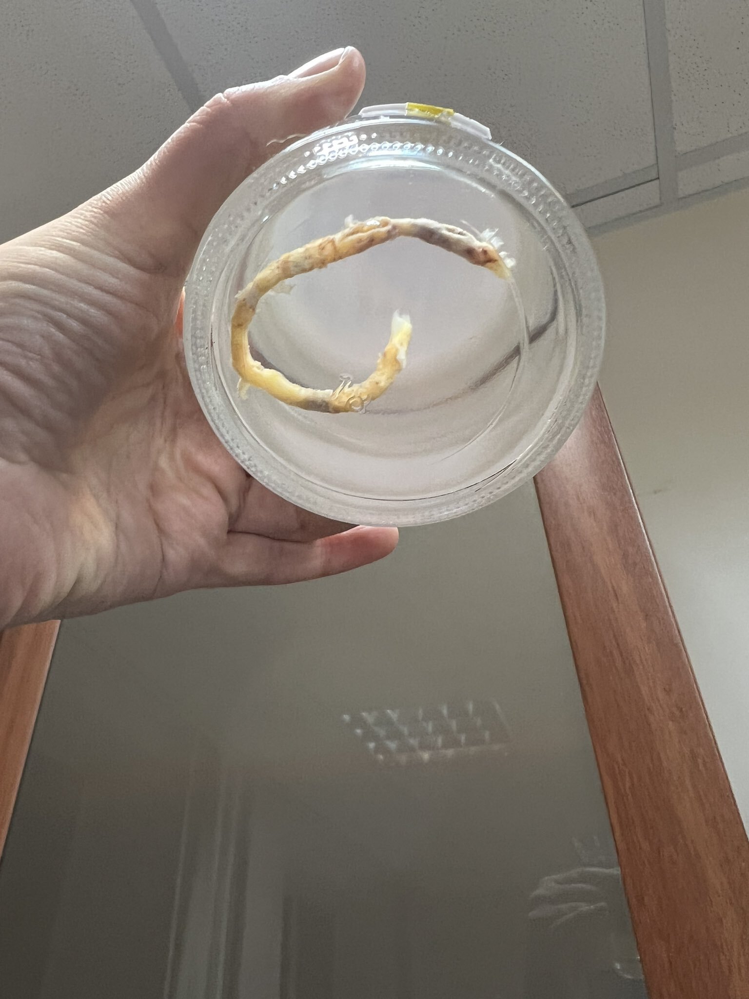 Бляшки в сосудах бывают и такие... | Пикабу