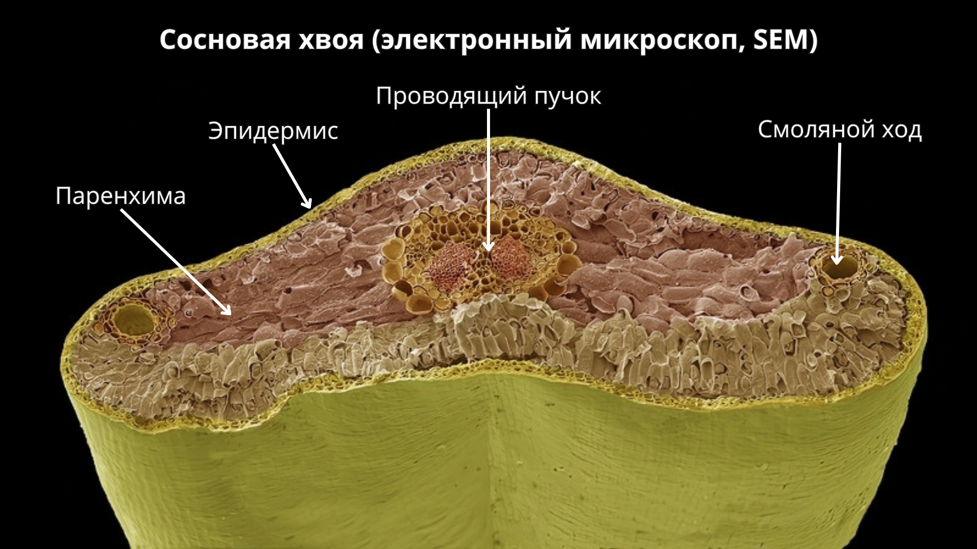 Сосновая хвоя под микроскопом | Пикабу